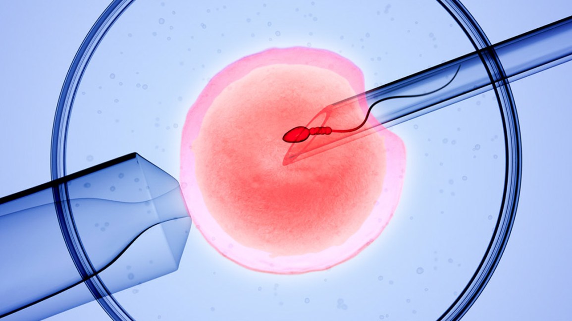 Your IVF Cycle - What to expect - Parla